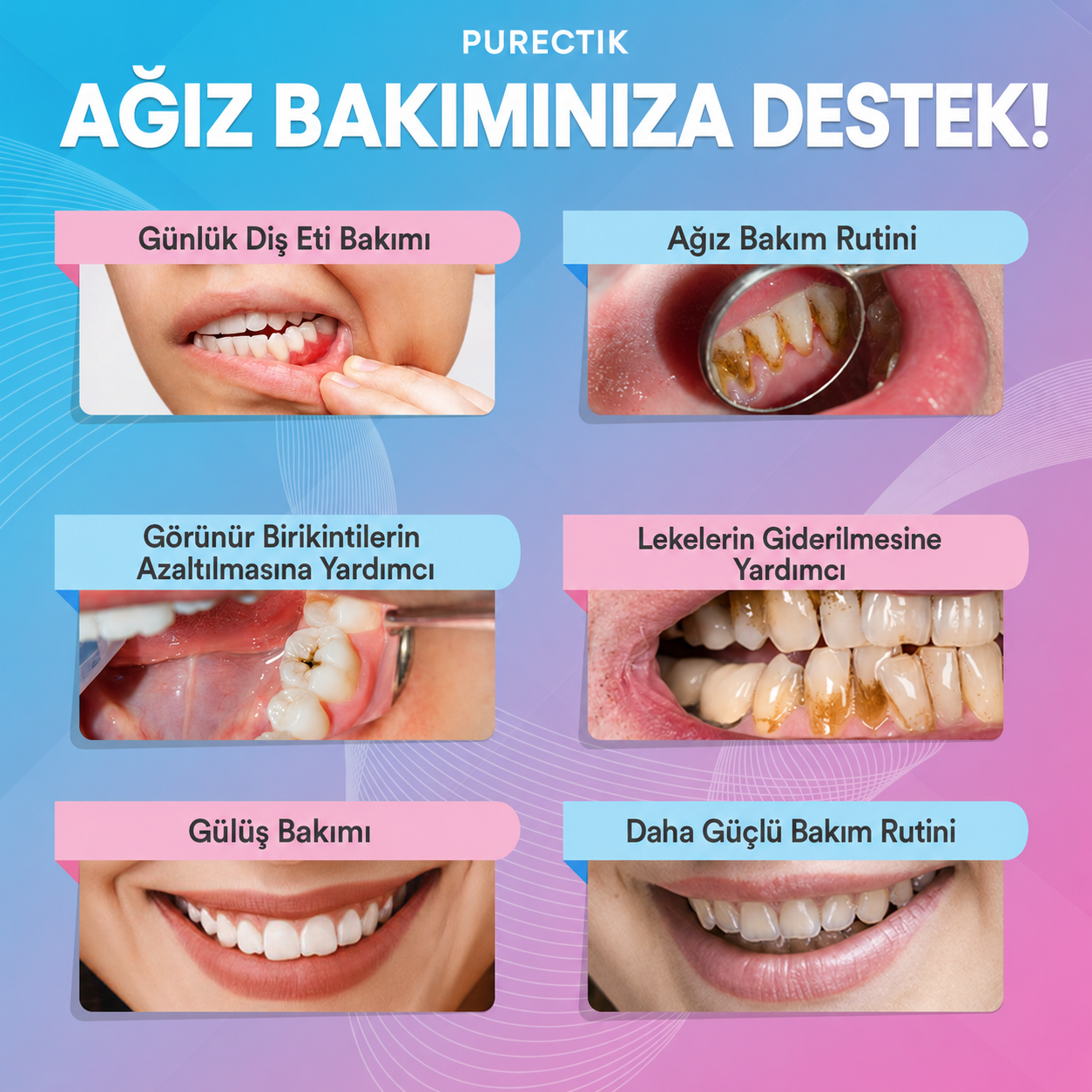 Purectik™ Ultrasonik Diş Temizleme Cihazı